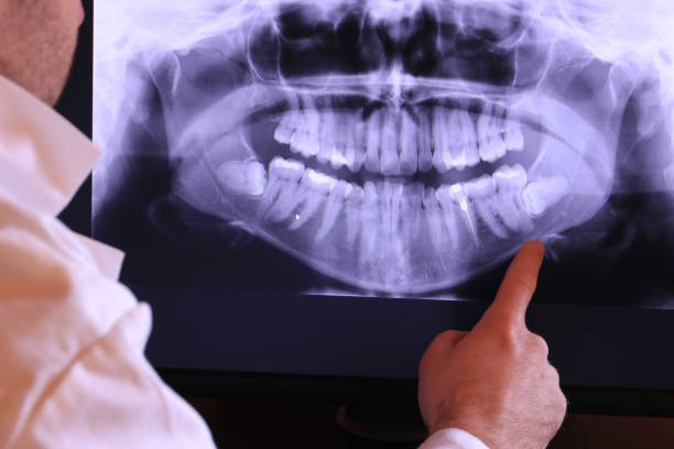 Best Knocked-Out Tooth Emergency  in Neillsville, WI