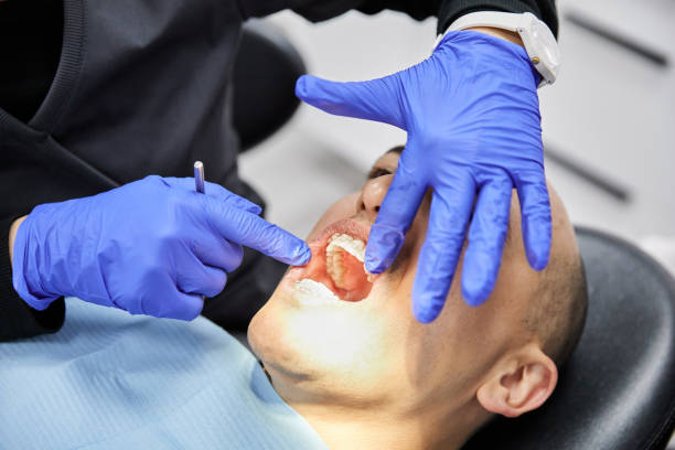 Best Dentist for Tooth Abscess  in Neillsville, WI